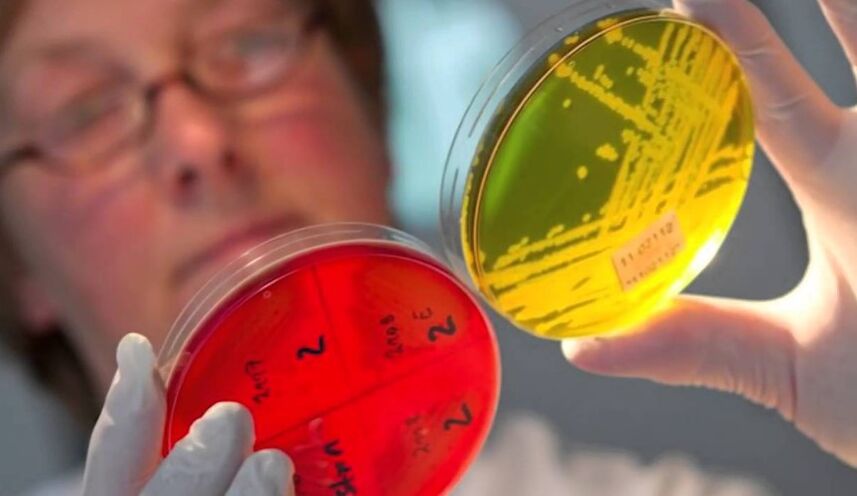 Diagnosis of parasite in the human body