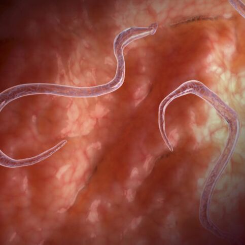 Parasites in guts