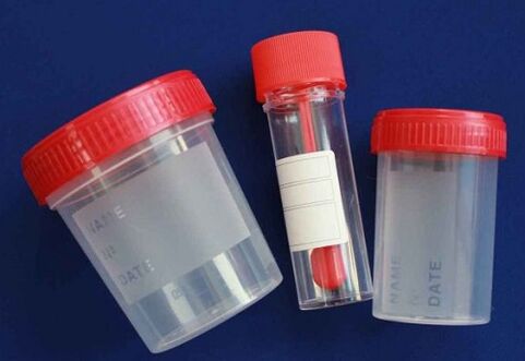 parasite testing jars