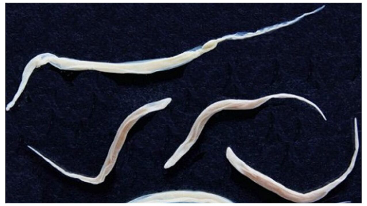 Pinworms are common parasites that belong to the helminth group.